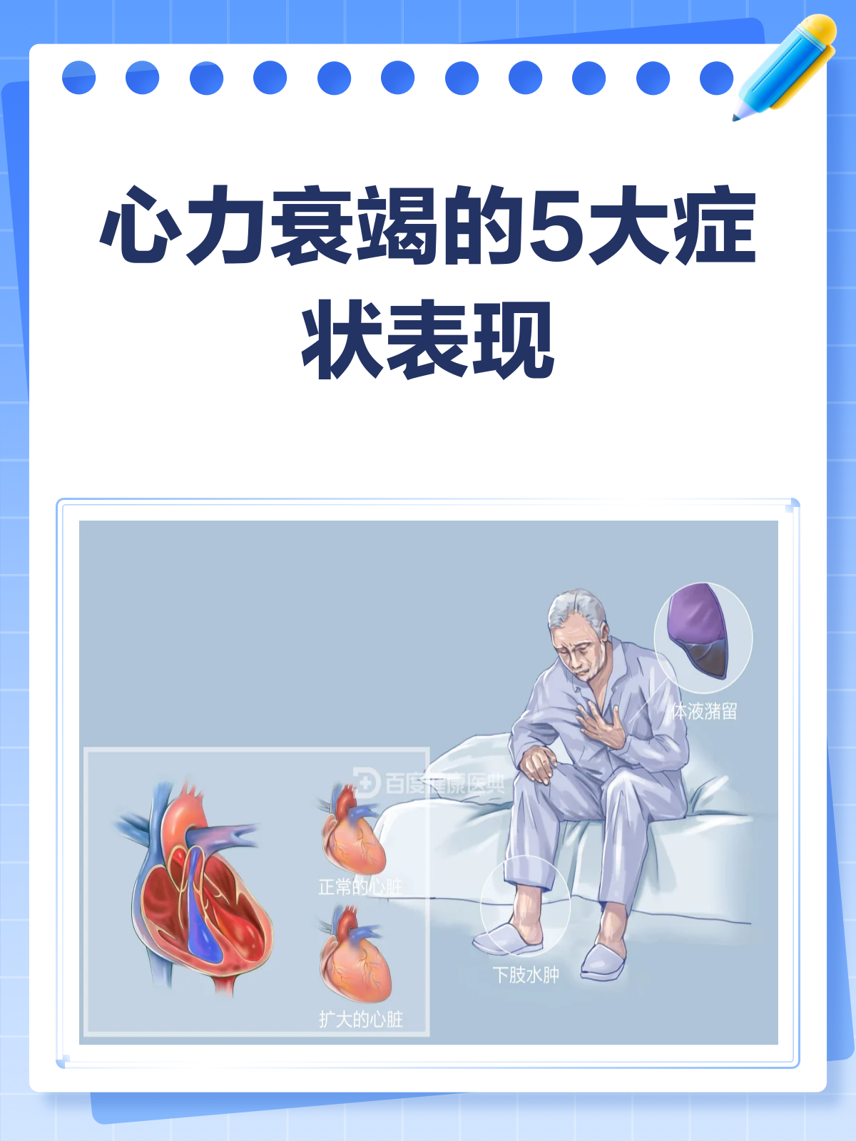 引起心力衰竭的病因有哪些