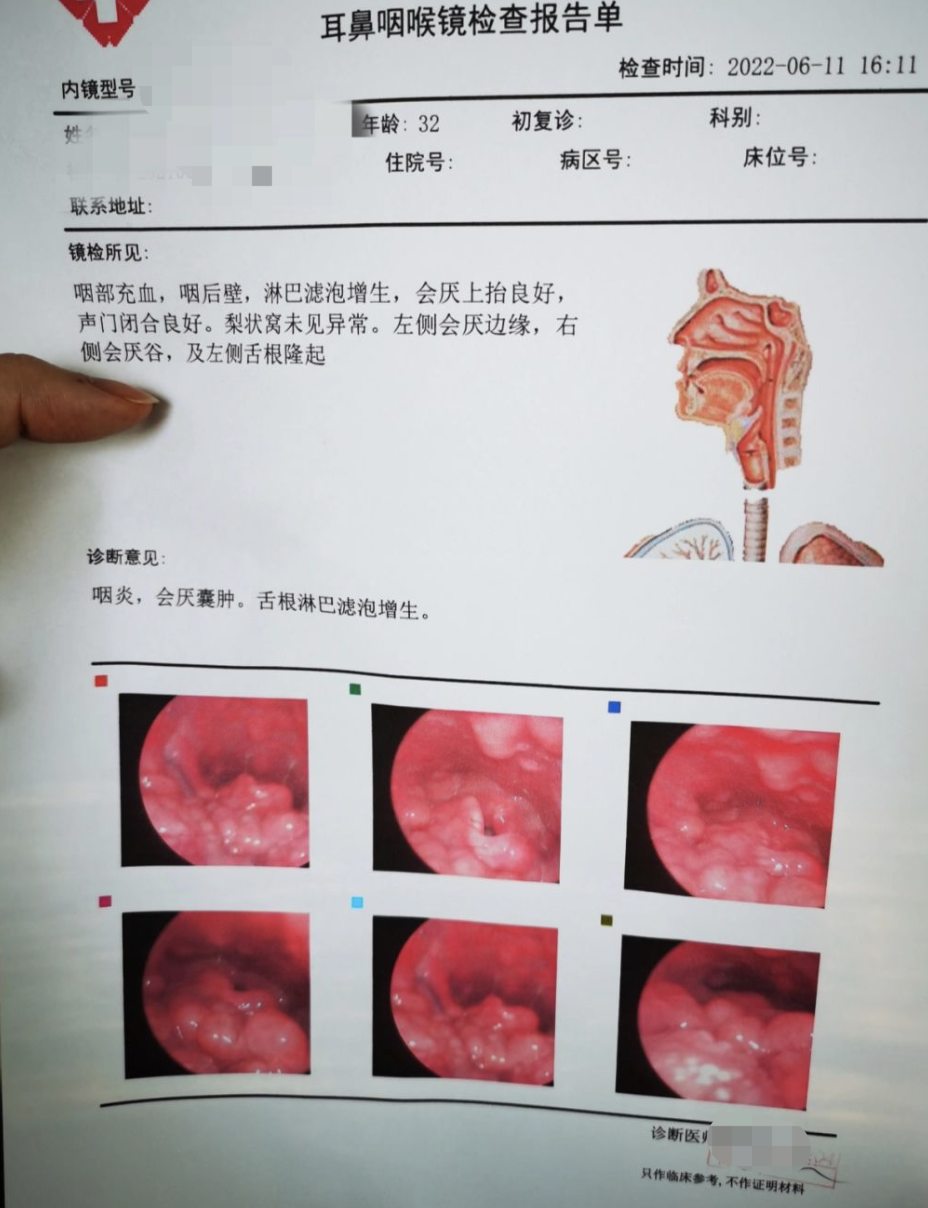 喉咙上长东西怎么办?