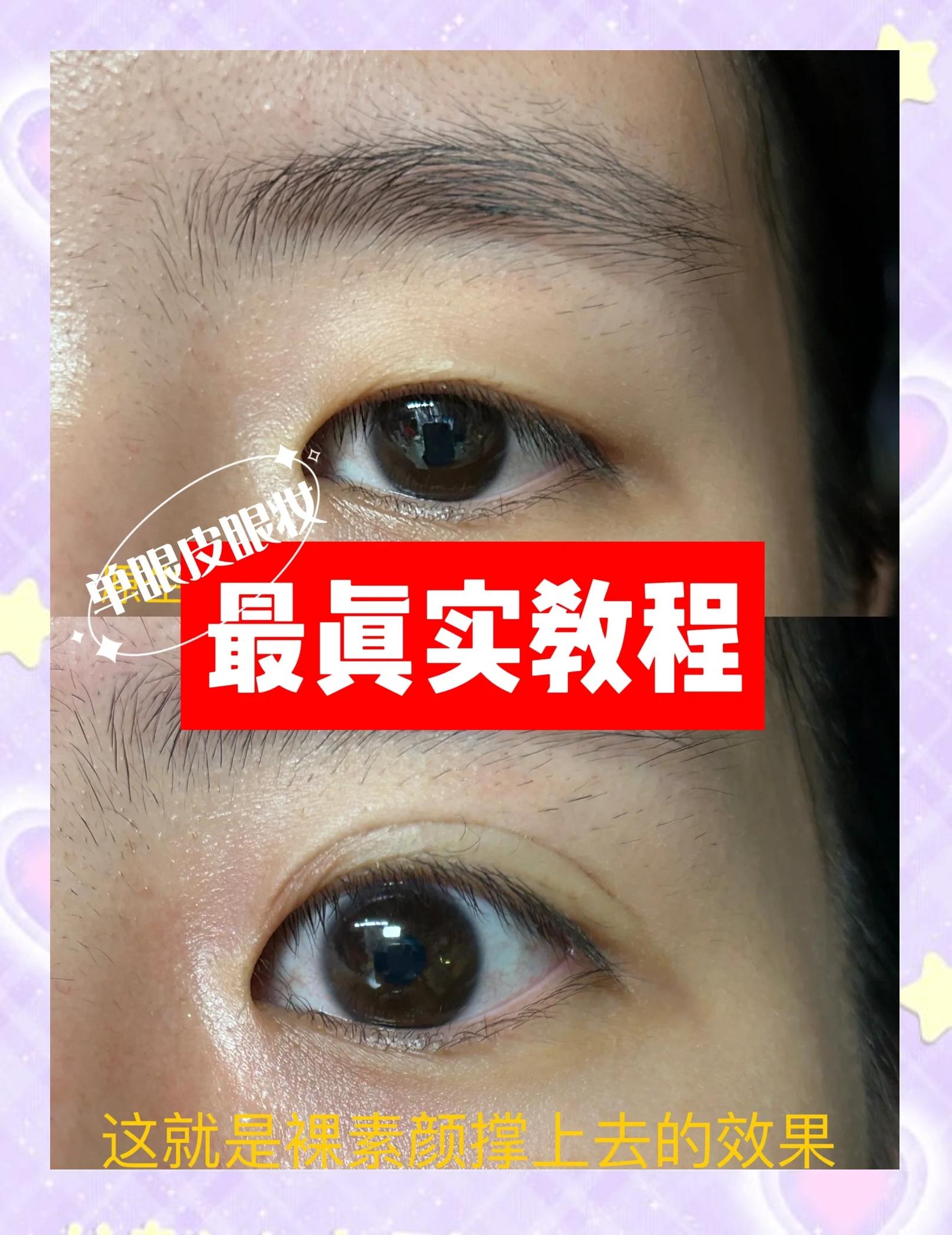 眼睛里面进胶水怎么办