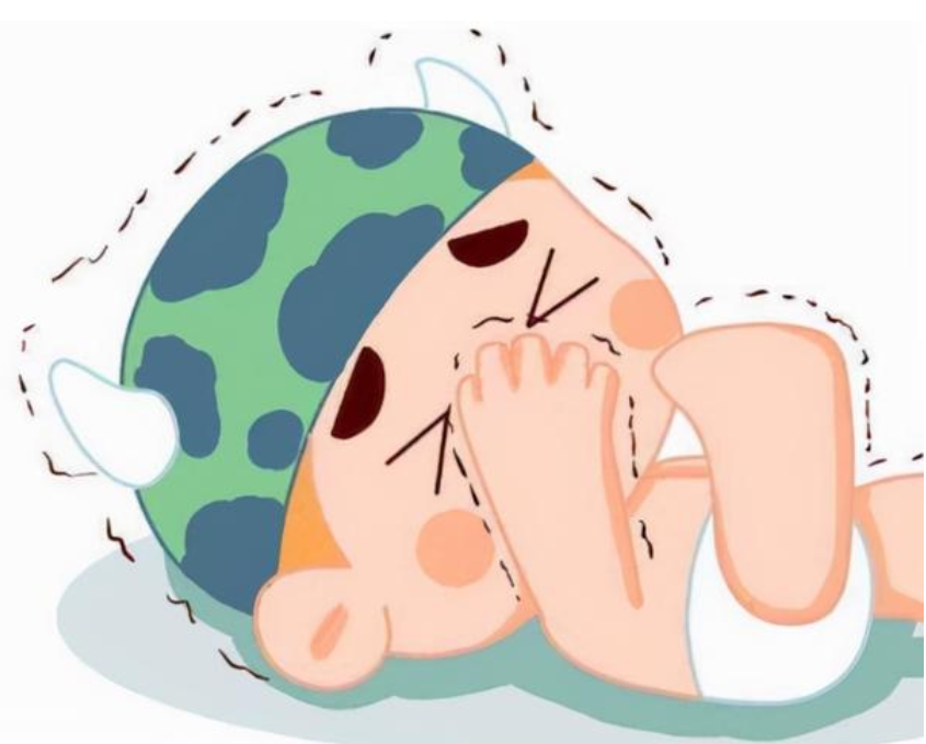 婴儿痉挛症的临床表现