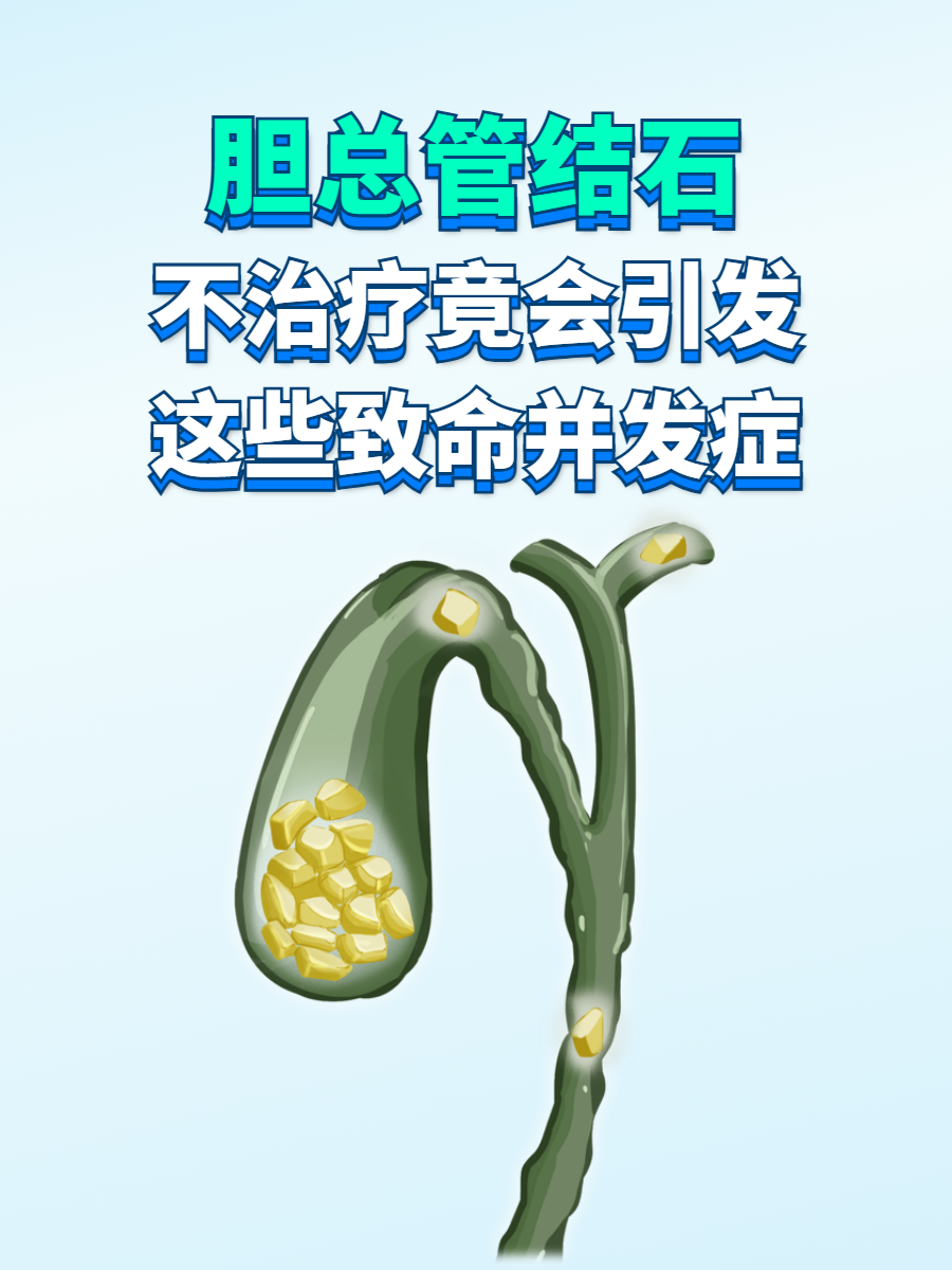肝内胆管结石要紧吗?