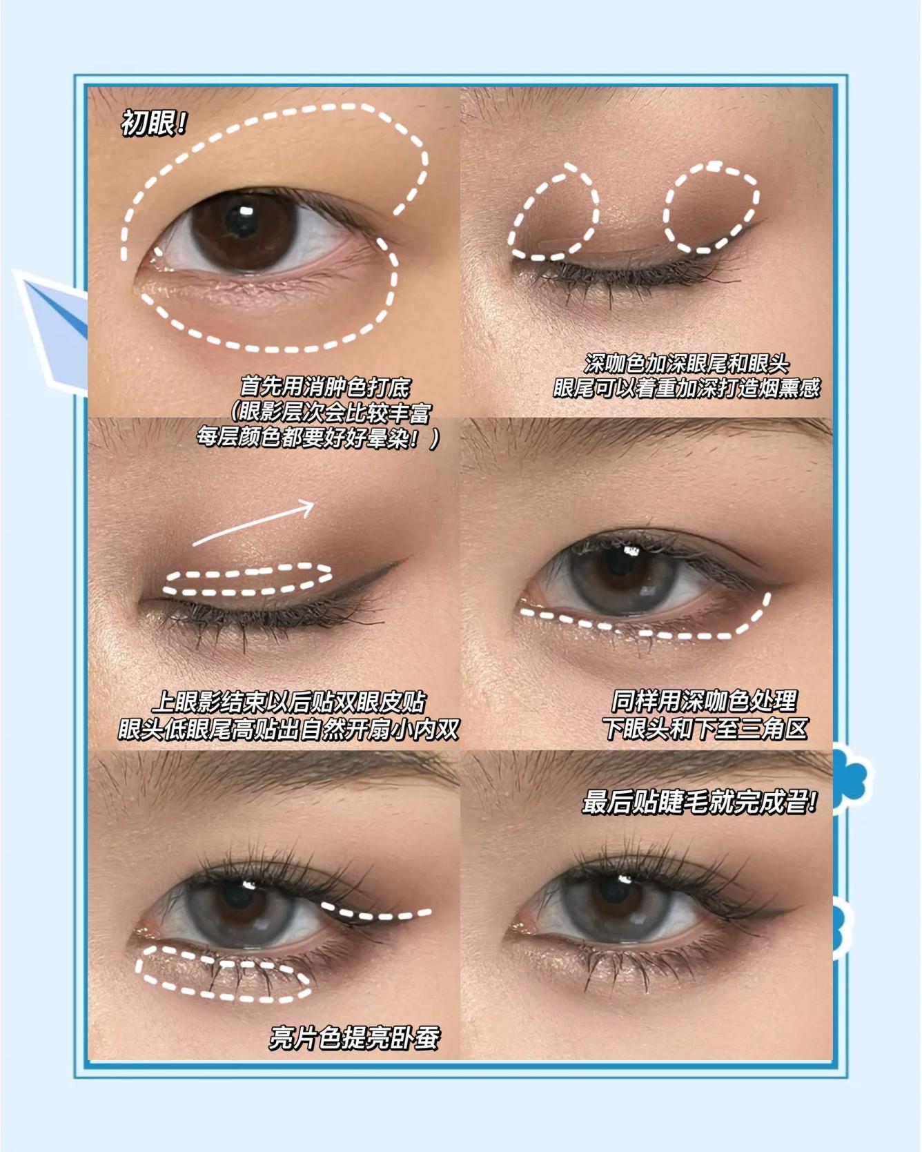 割双眼皮的方法有哪几种？