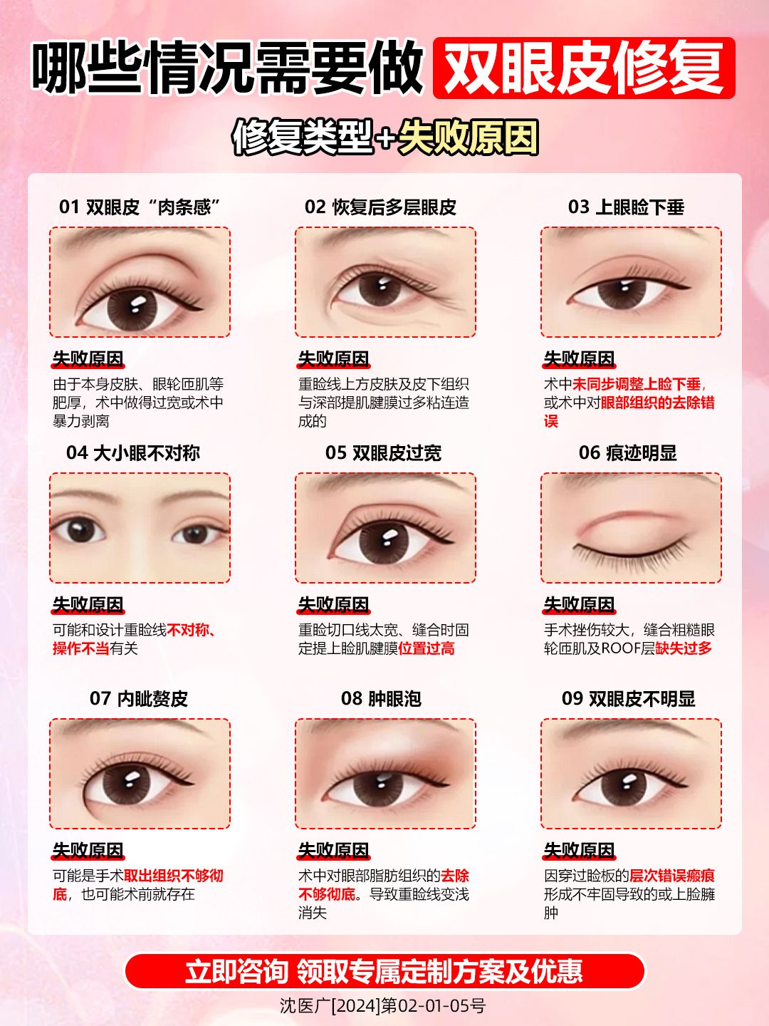 割双眼皮的方法有哪几种?