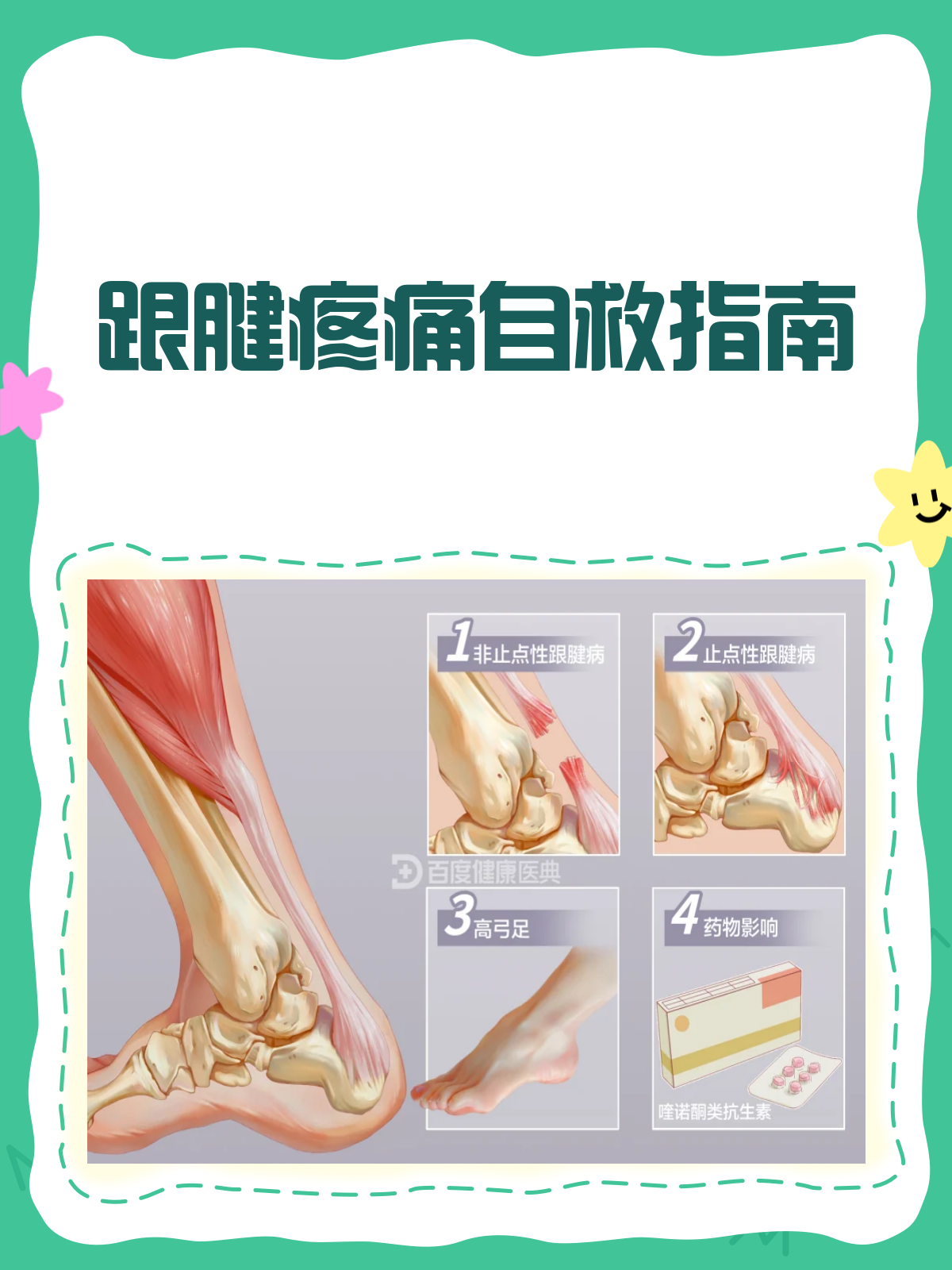 脚后跟上面的筋疼怎么办