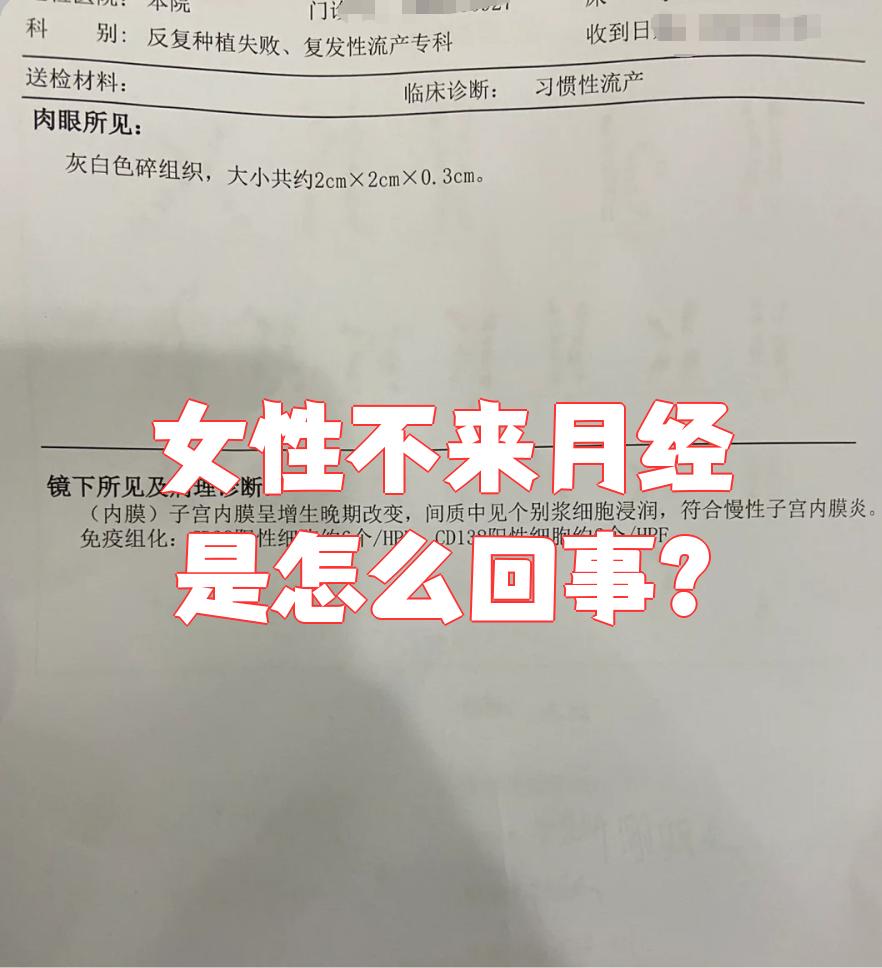 不来月经会怀孕吗
