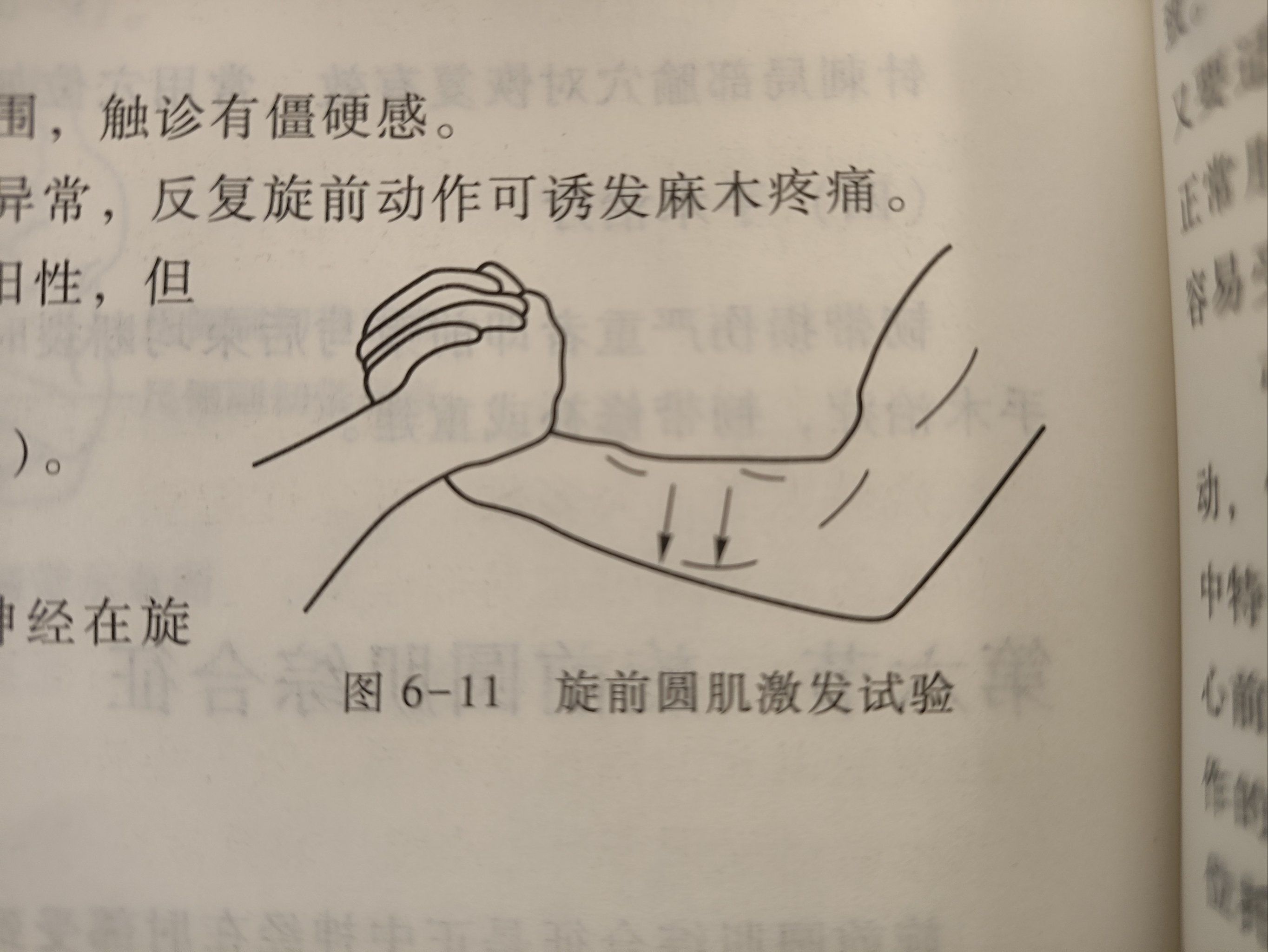 正中神经损伤怎么办