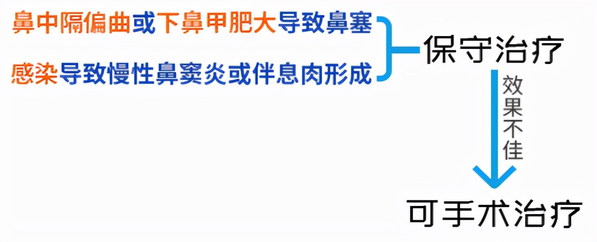 鼻甲肥大手术费用是多少