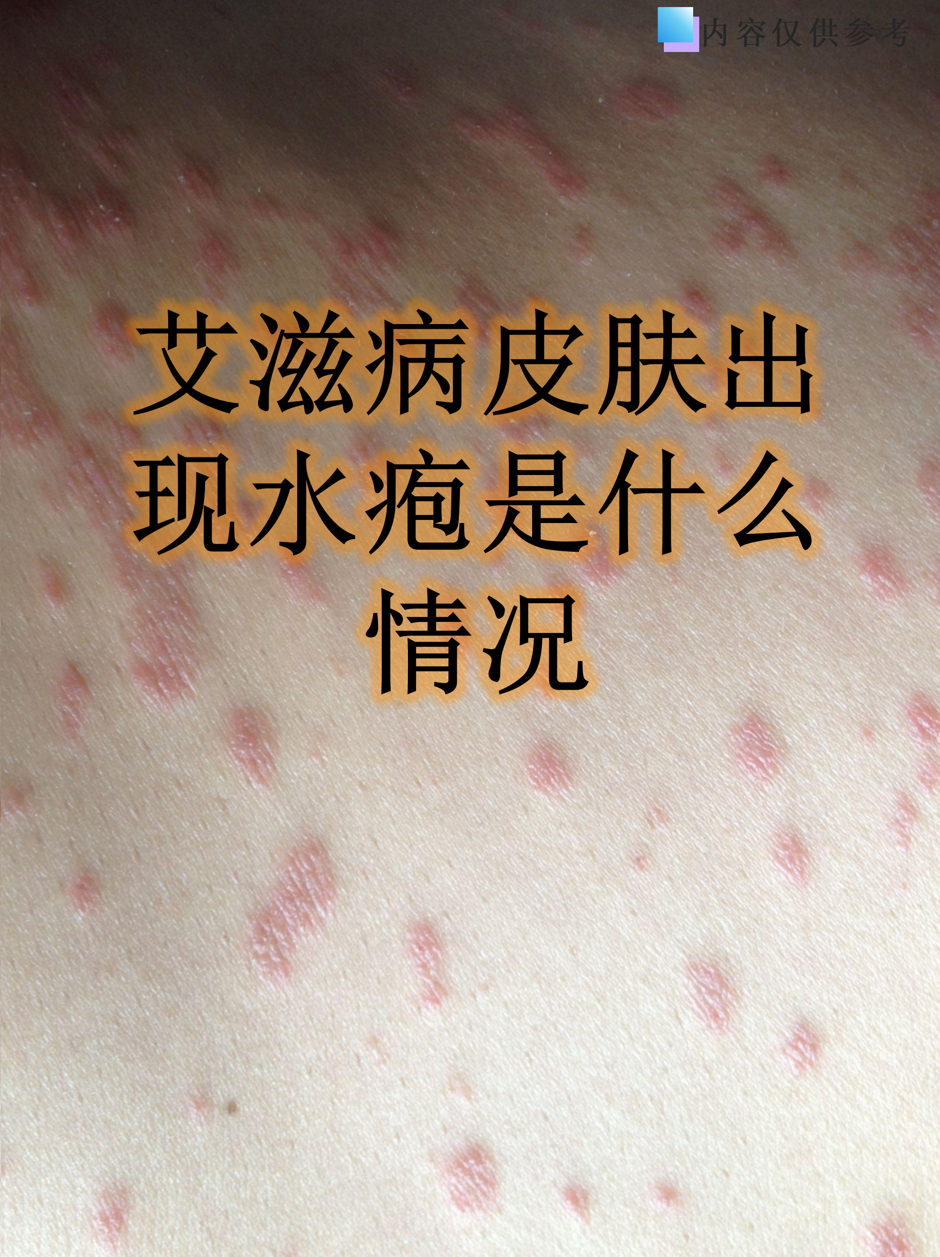 哪些症状是艾滋病晚期