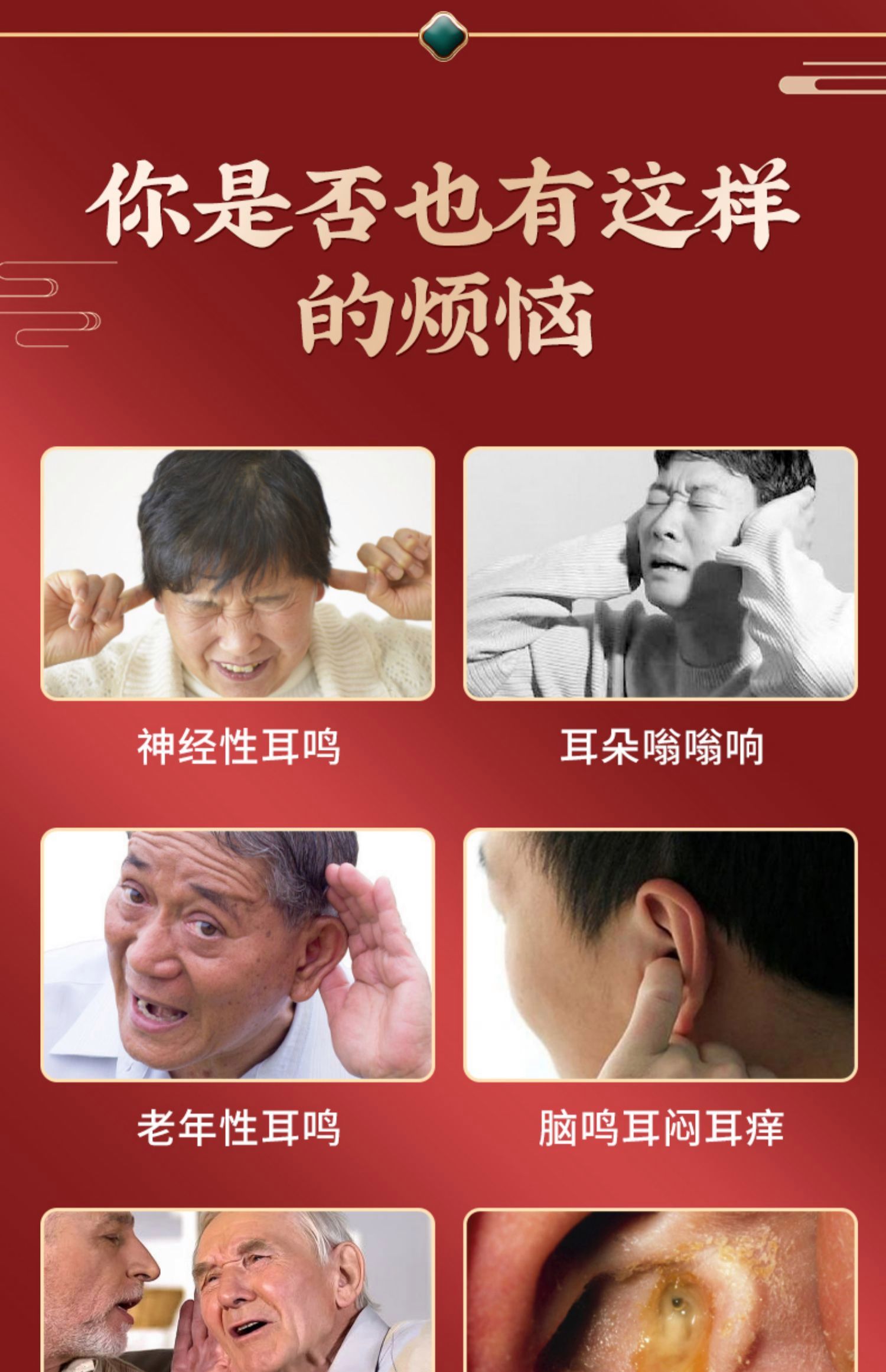 神经性耳鸣可以自愈吗