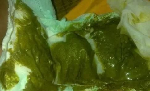 大便有点深墨绿色怎么回事