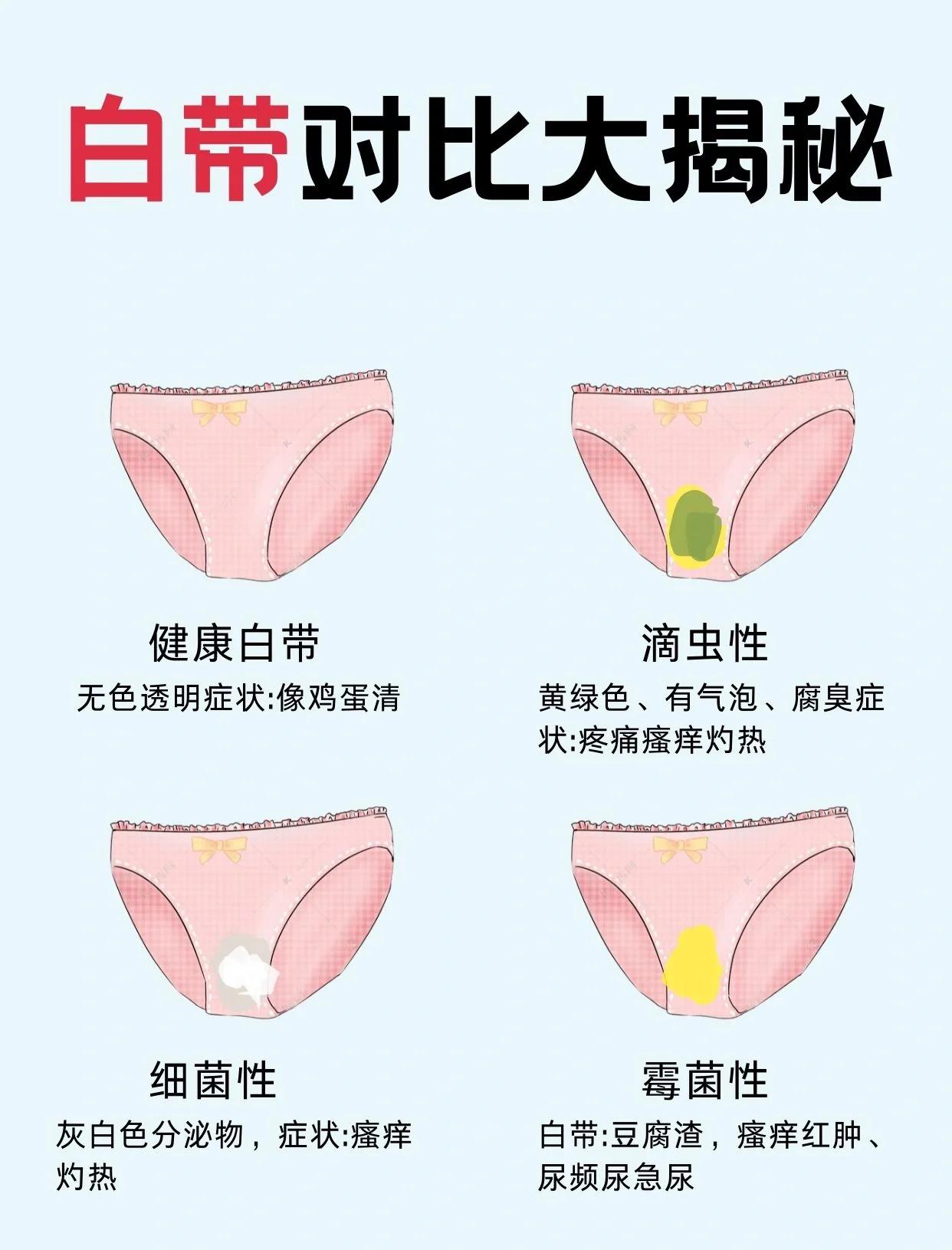 白带怎样算正常?