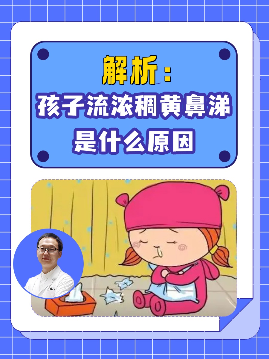 浓黄鼻涕怎么回事
