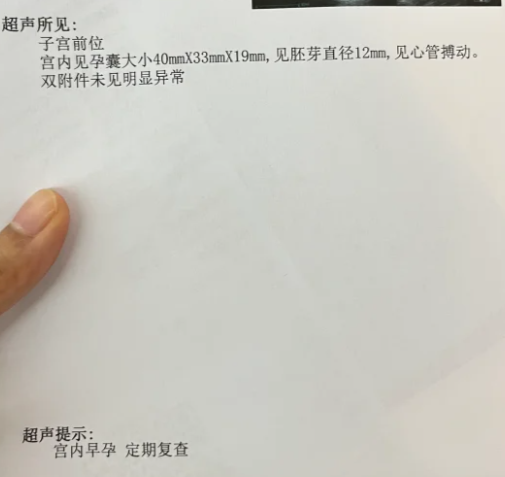 怀孕多久能看到孕囊