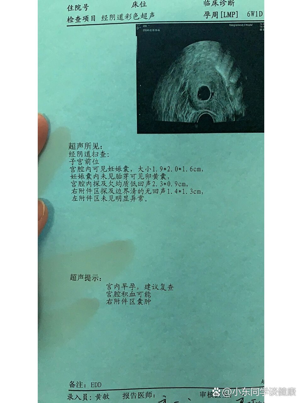 怀孕60天,未见胎芽胎心,