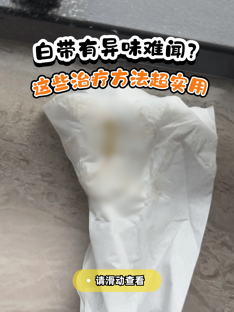 白带多异味重