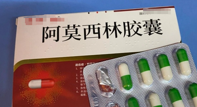 阿莫西林能治疗牙龈炎吗