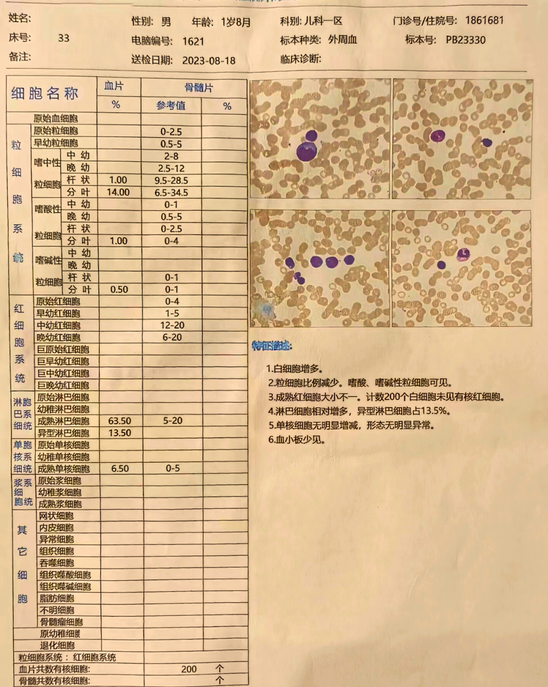 淋巴细胞偏高是怎么回事
