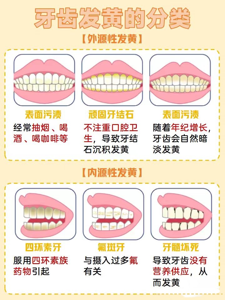 牙齿变白的小妙招有哪些