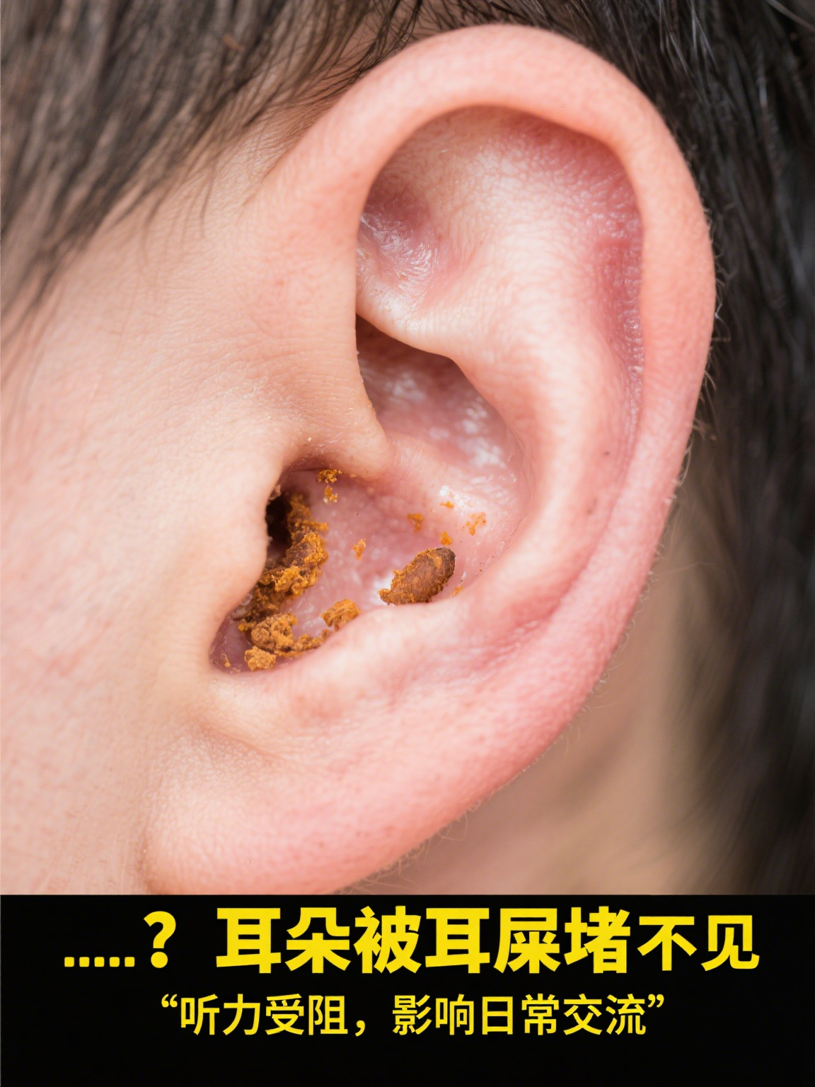 耳朵好像有股气堵住了是怎么回事