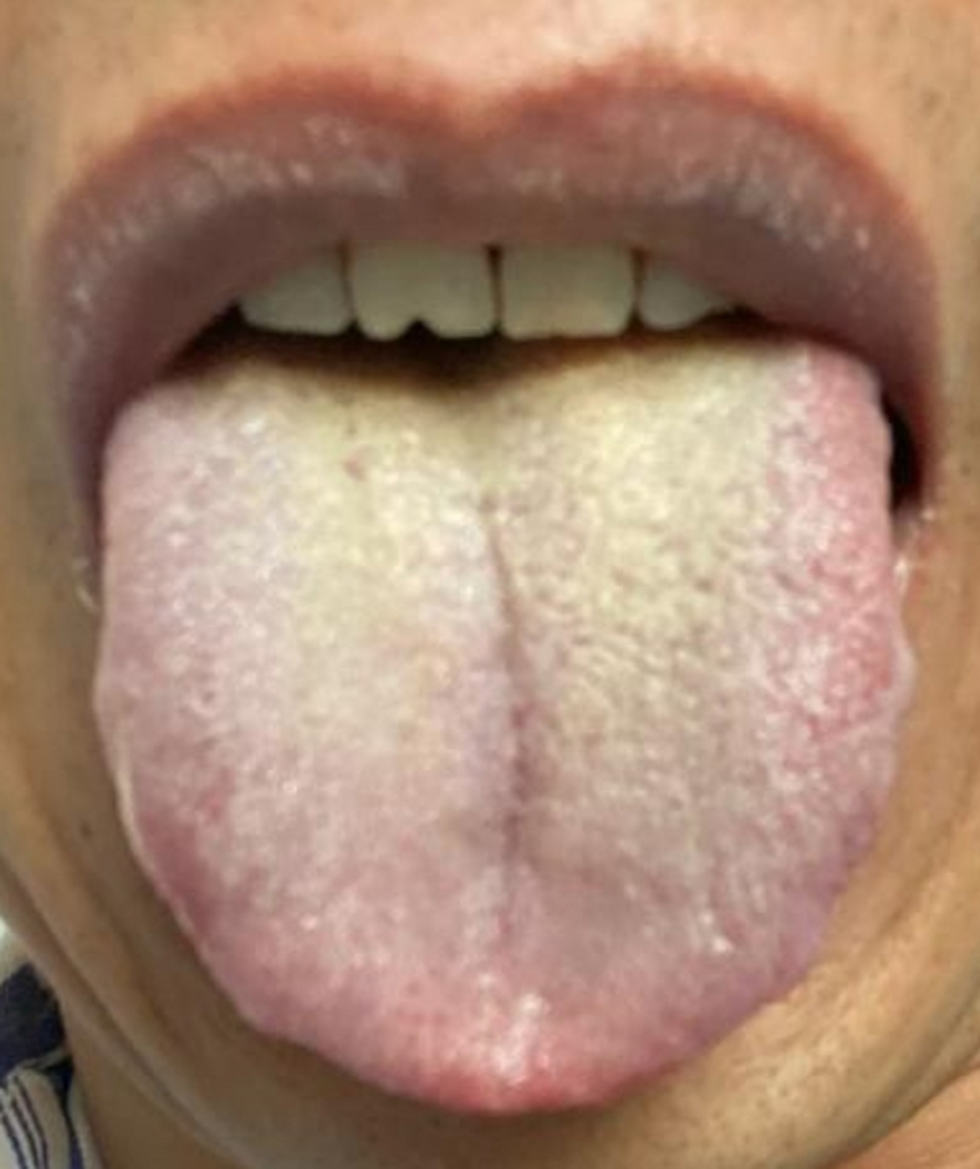 阳萎的表现有哪些症状