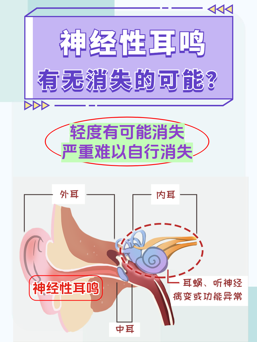 耳鸣的治疗方法有几种