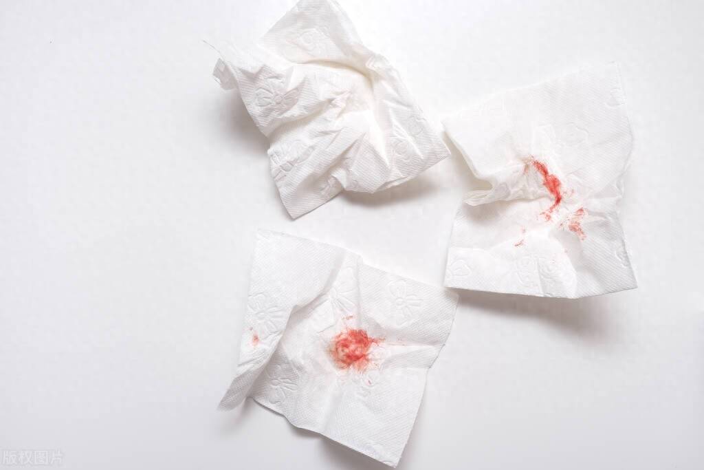 阴道出血是怎么回事