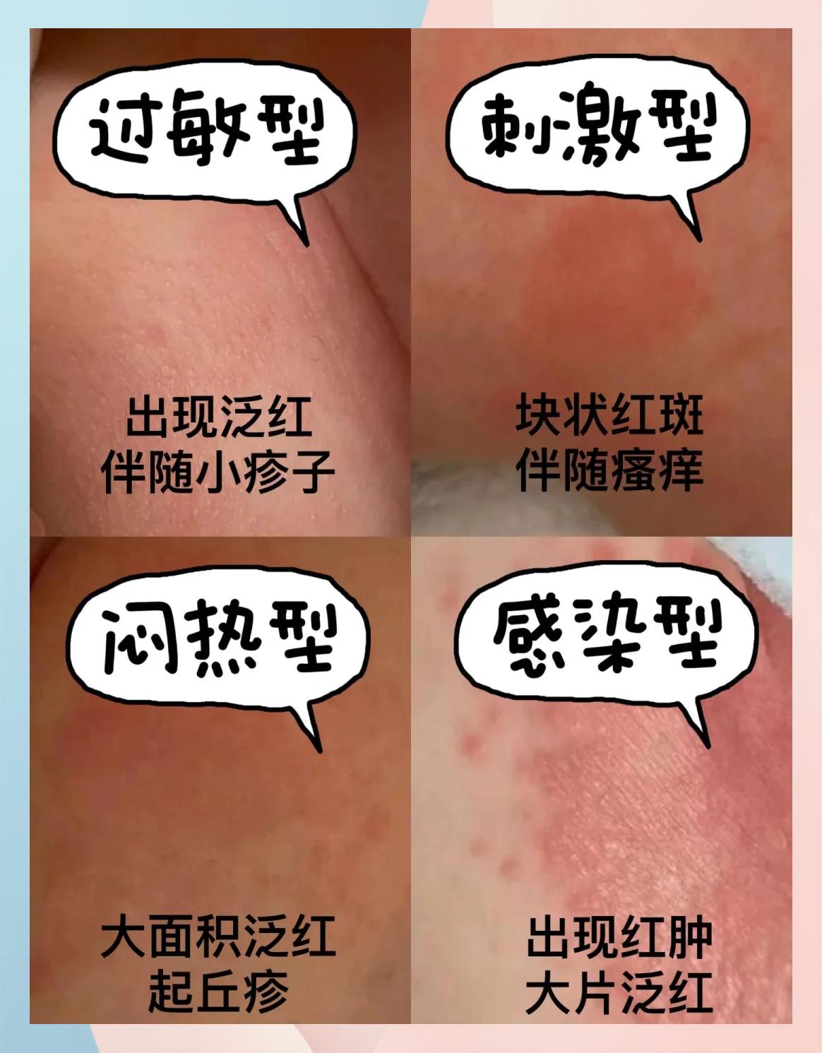 屁股眼痒痒是什么情况