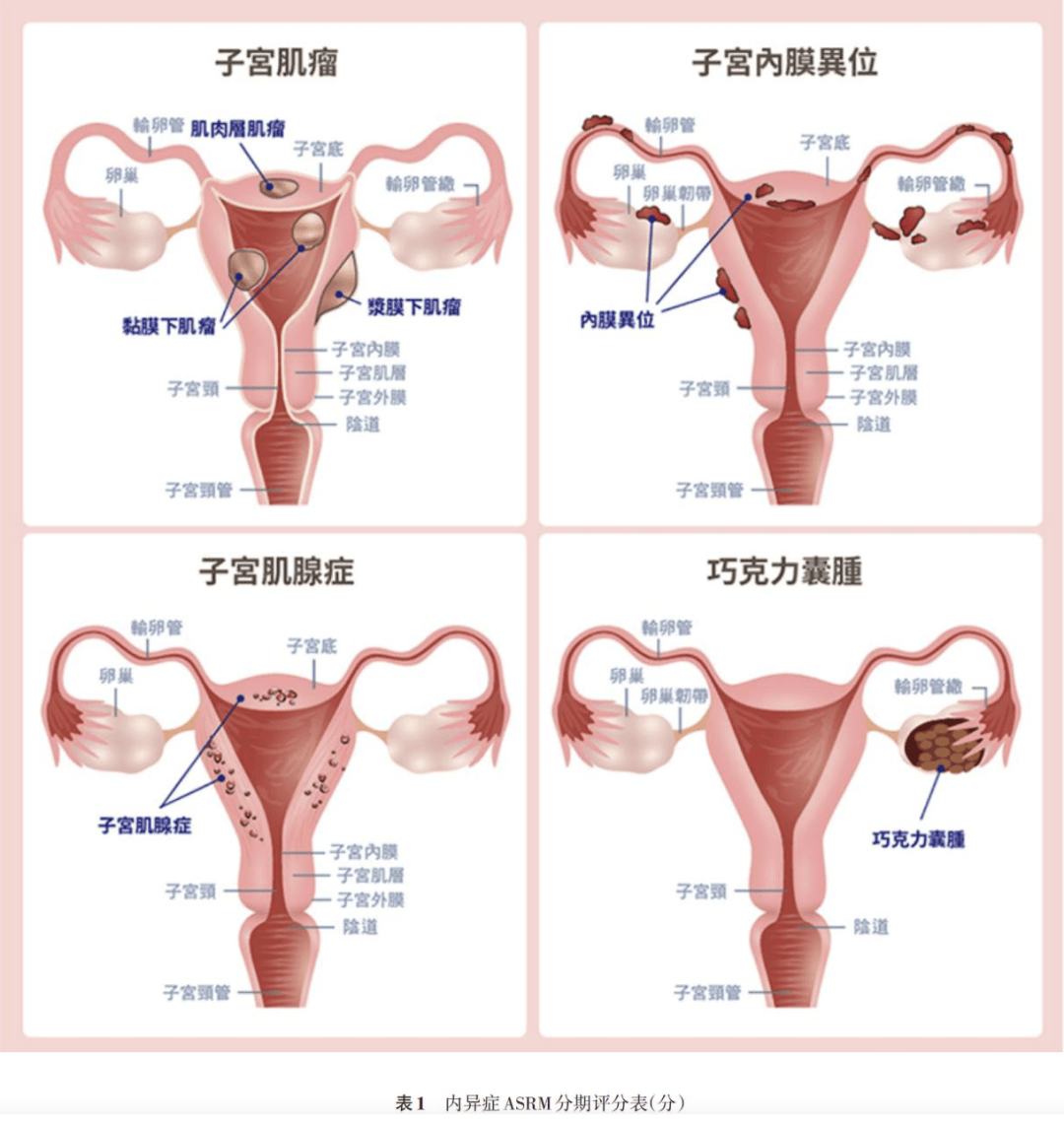 卵巢在哪个位置