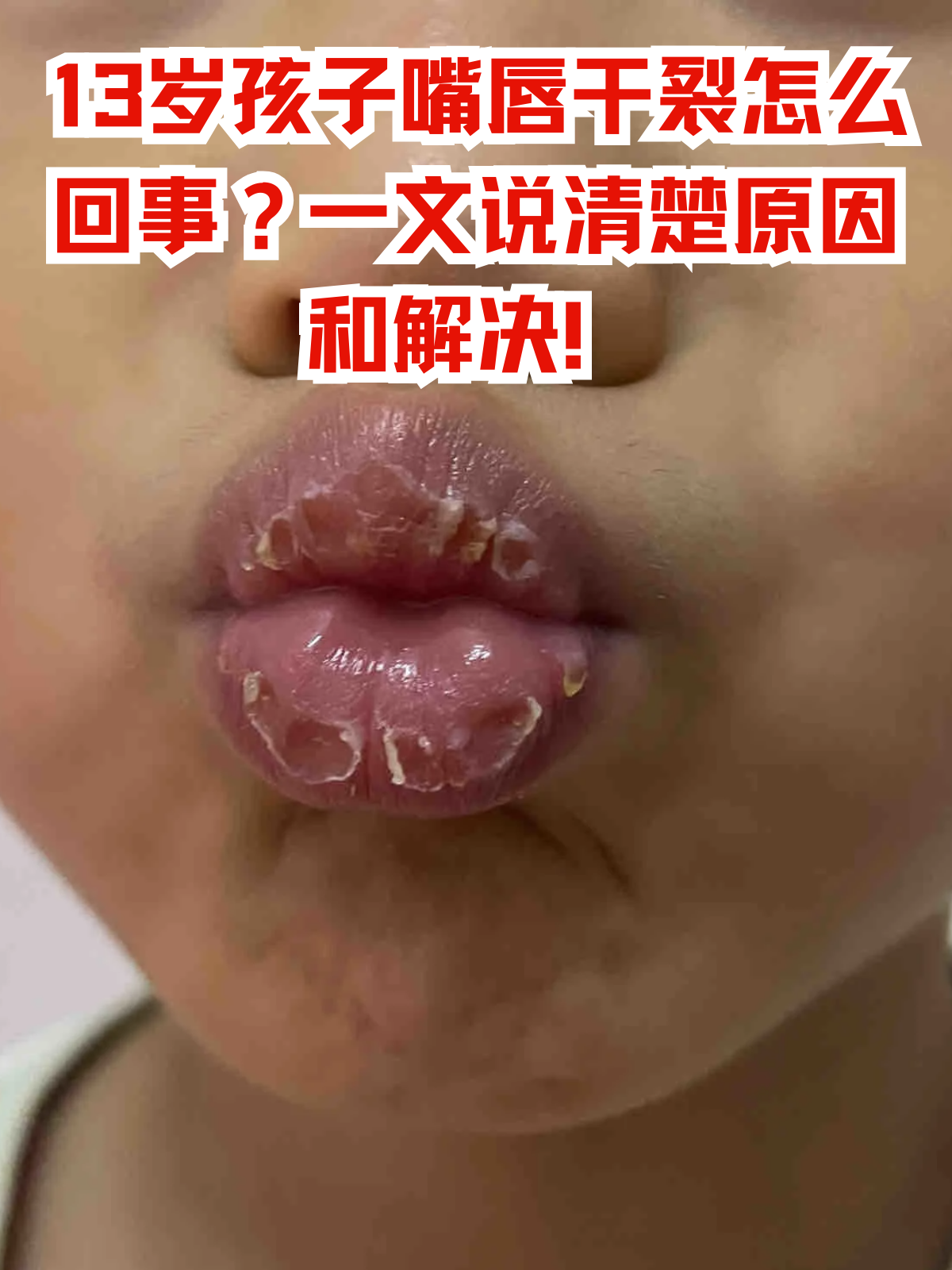 嘴唇发干咋回事