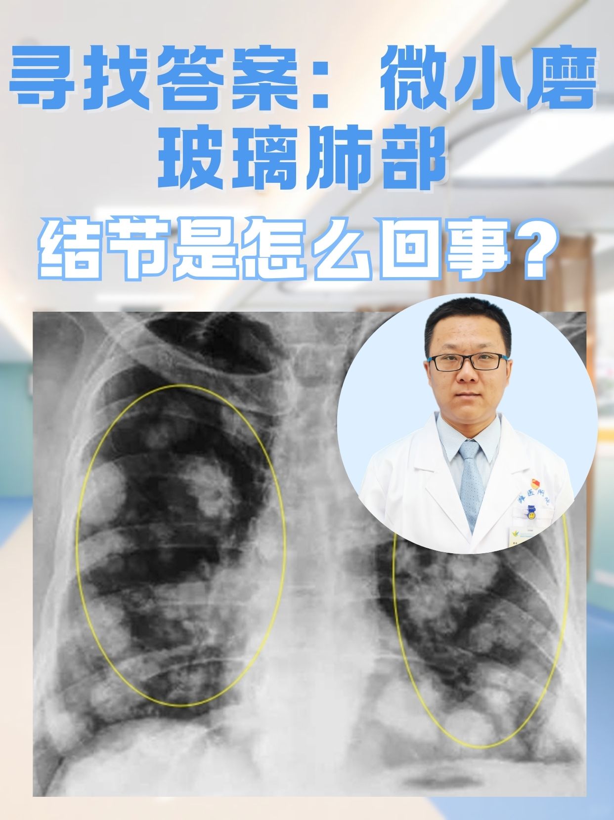 6mm肺部结节一年后没了是怎么回事