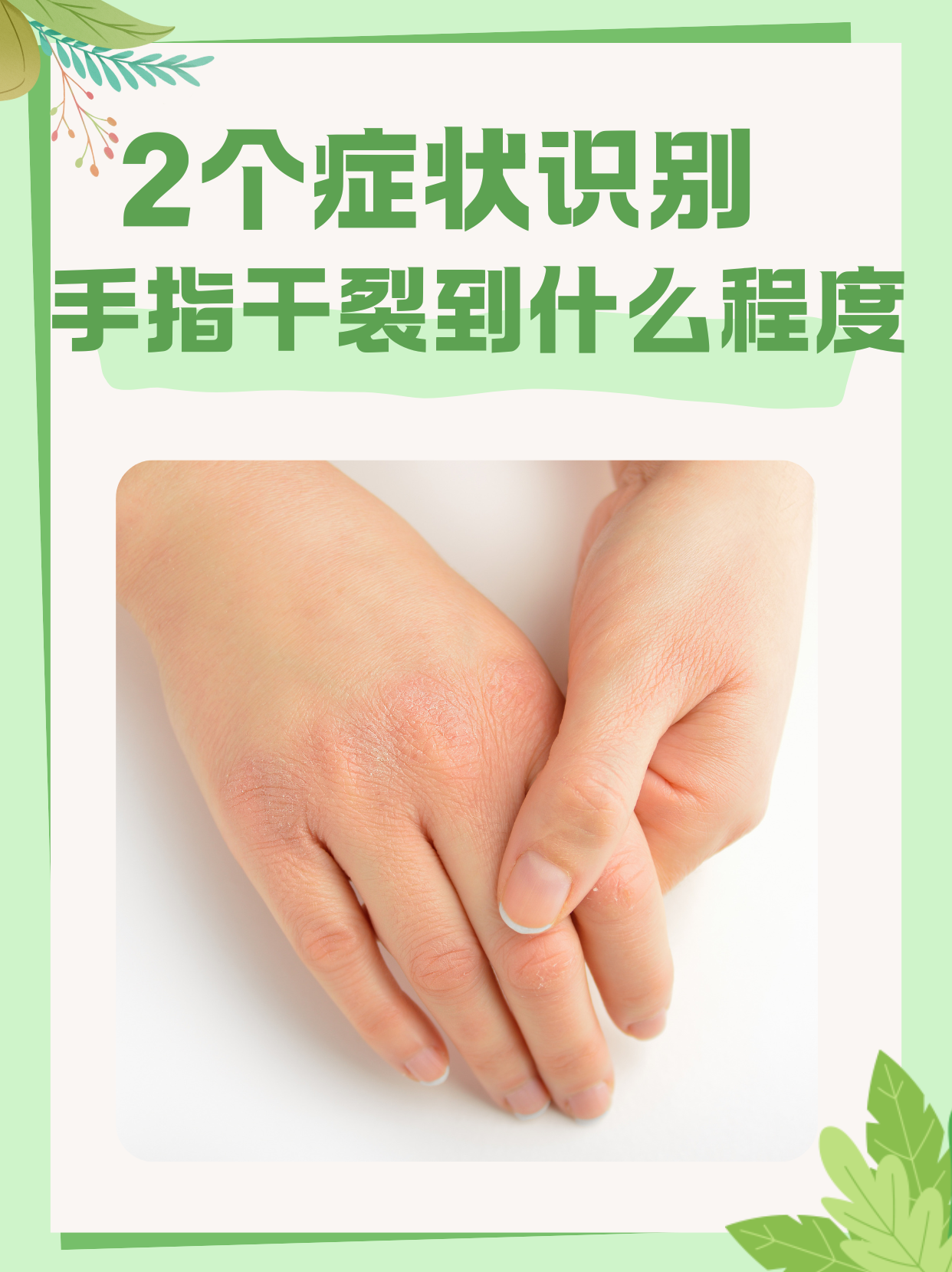 手指脱皮是什么原因引起的?