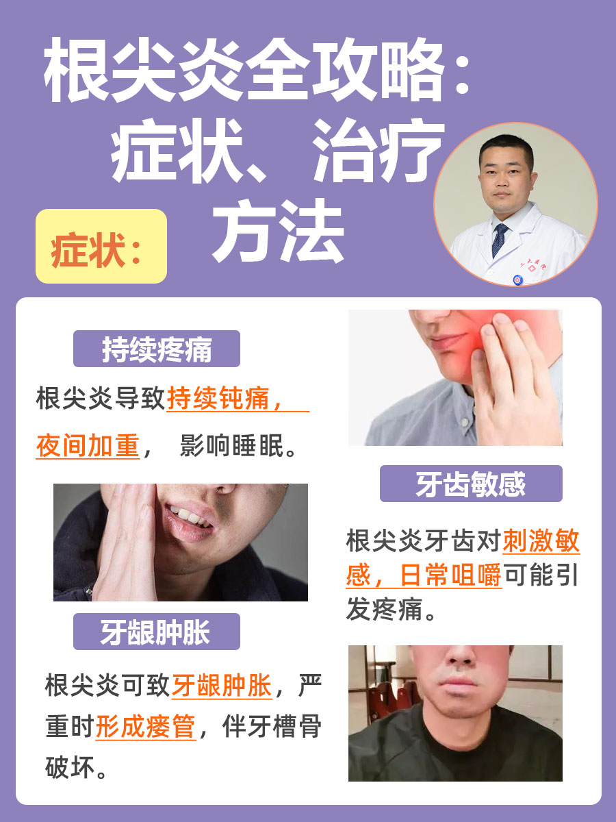 急性牙髓炎的症状有哪些?