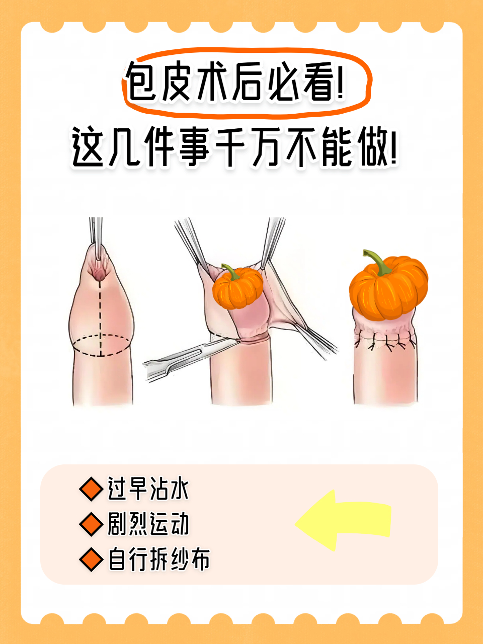 包皮术后线多久能脱落