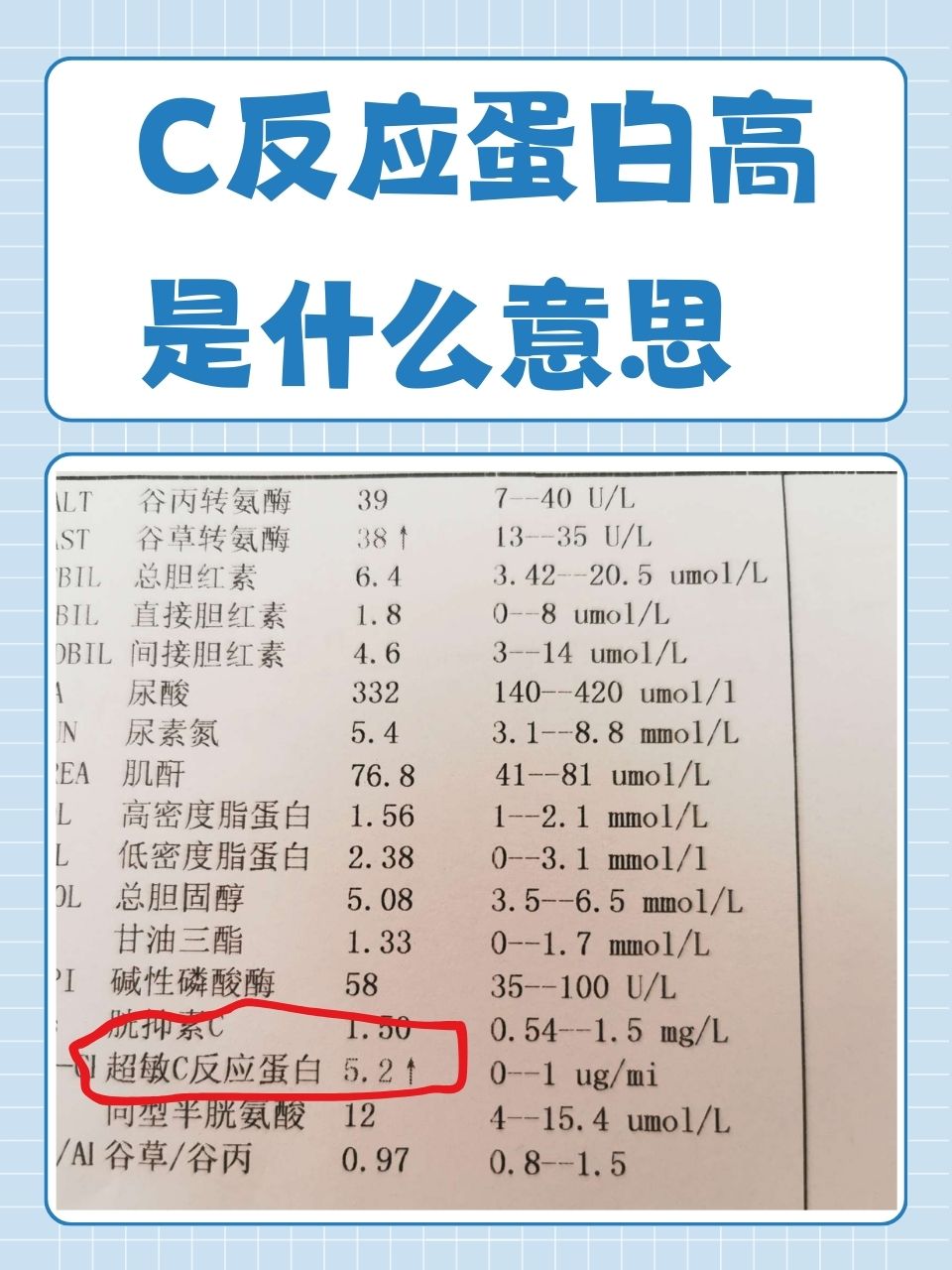 肌酸激酶偏高是怎么回事