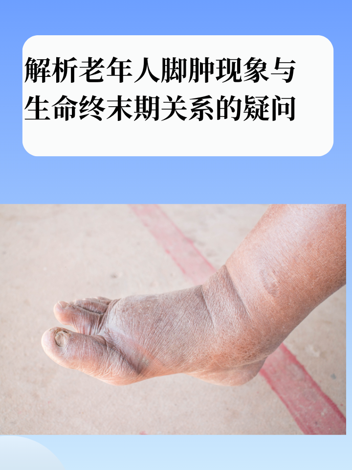 脚肿是什么原因