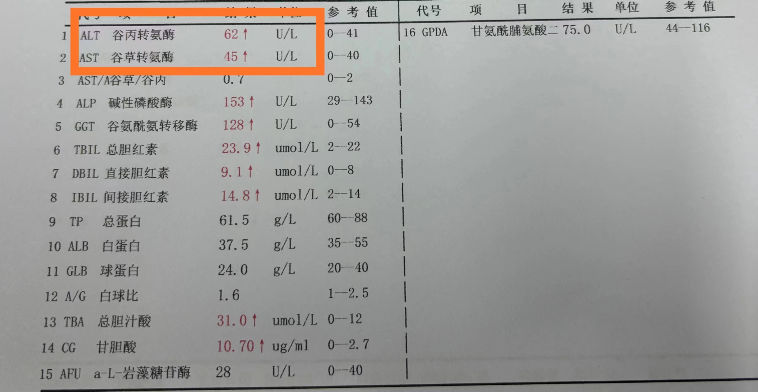 谷丙谷草转氨酶偏高