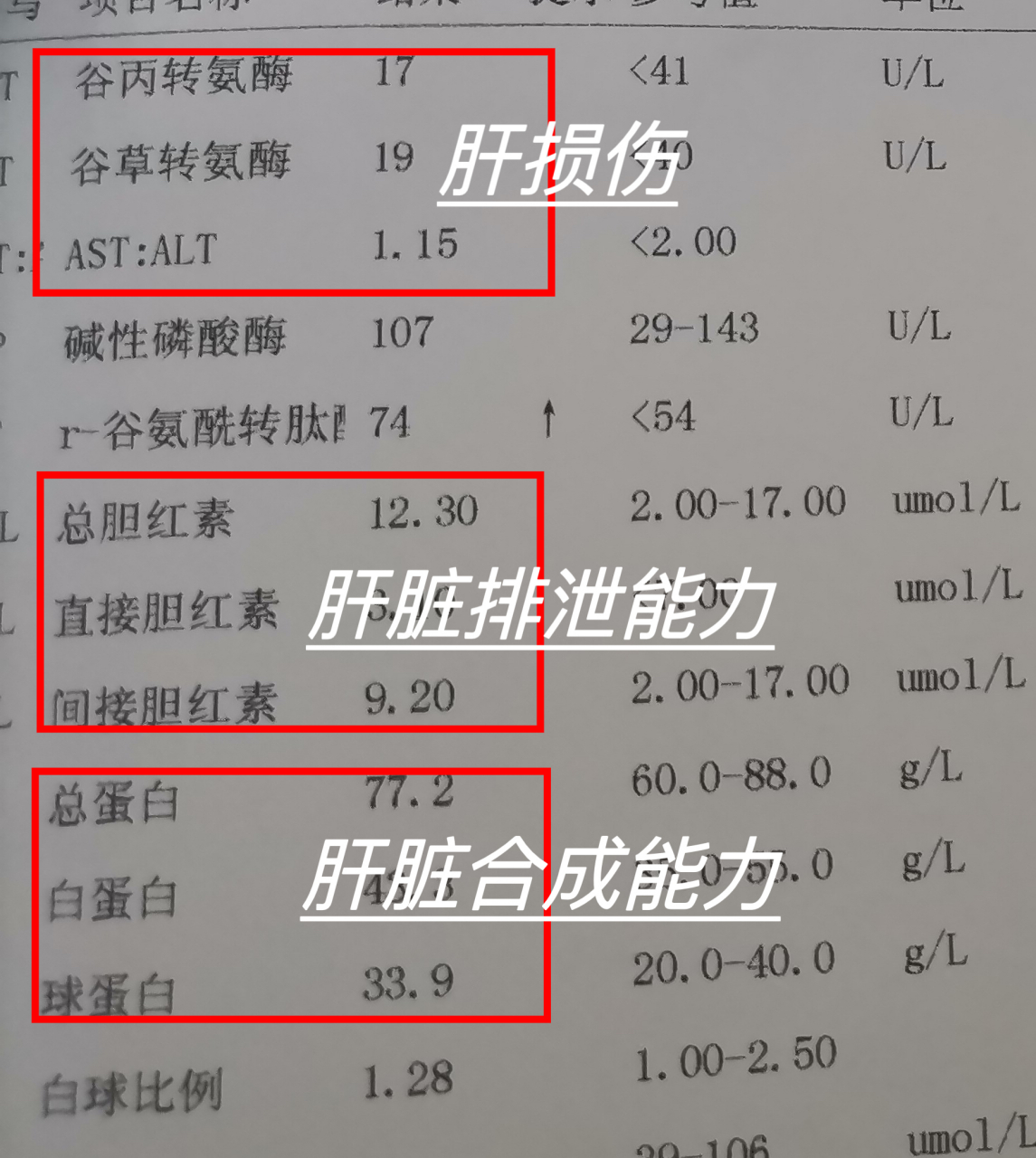 谷丙谷草转氨酶偏高