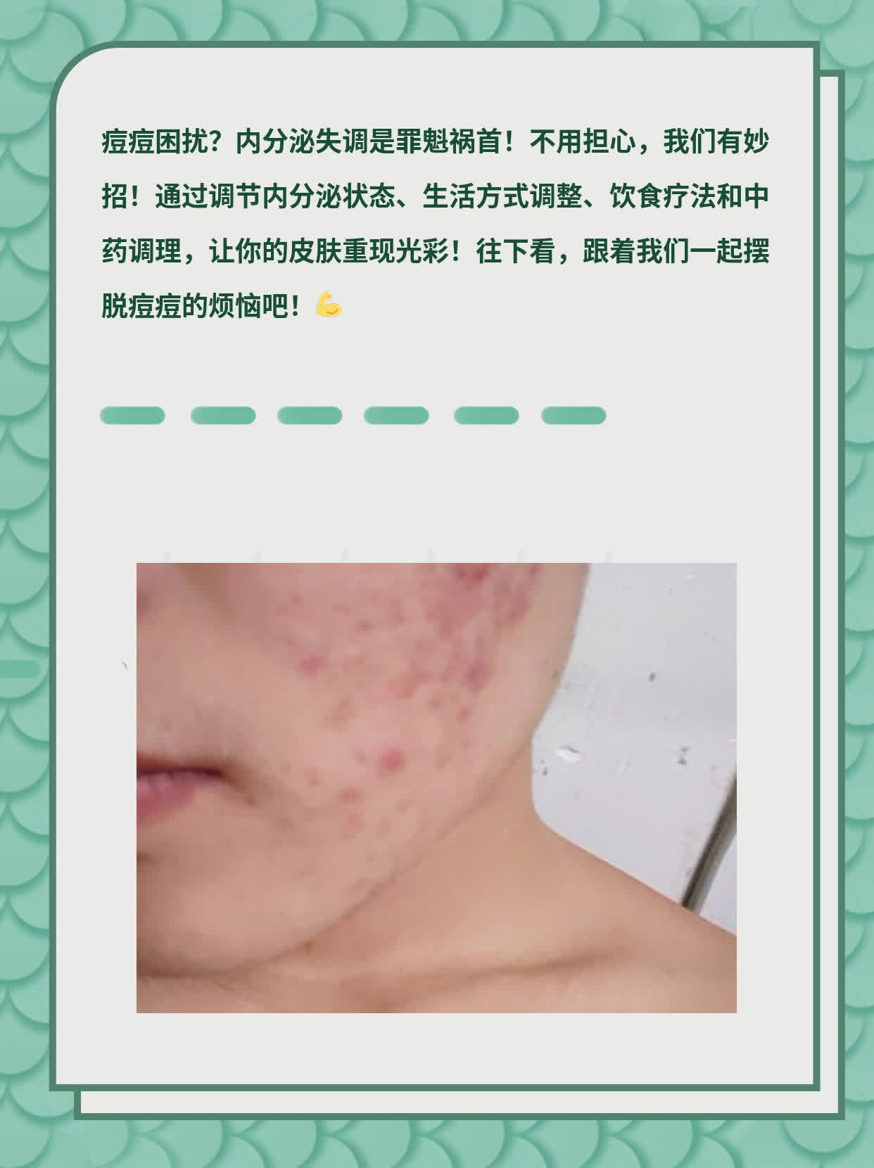 女人内分泌紊乱的表现有哪些