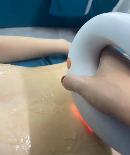 肚子上长毛是什么原因啊