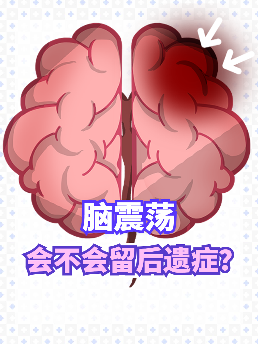 轻微脑震荡的症状有哪些