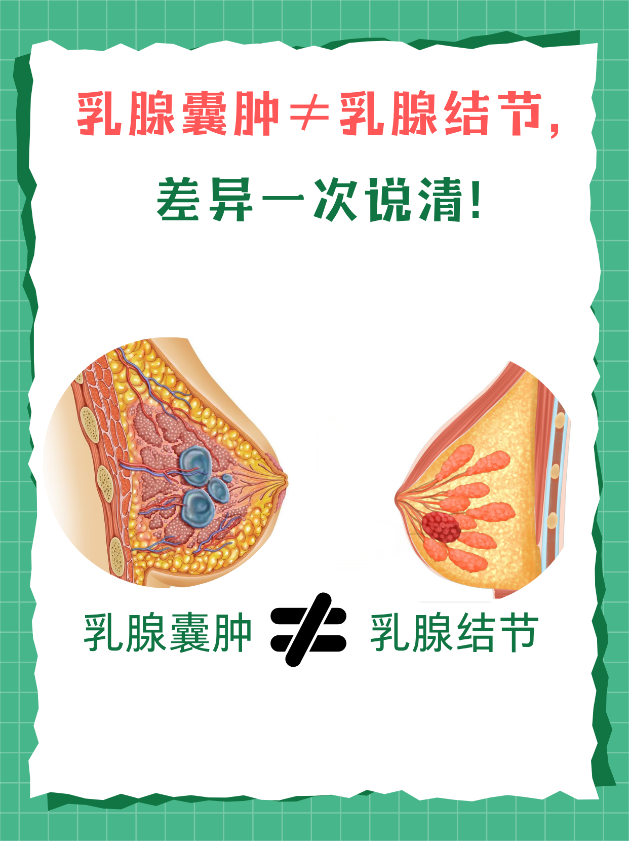 乳腺有结节怎么回事