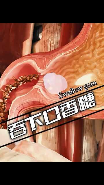 泡泡糖吞下去怎么办?