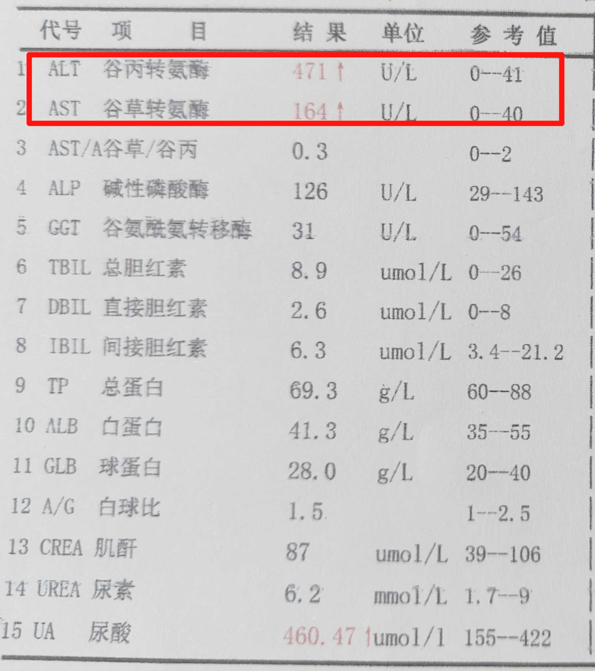 肝功检查结果怎么分析