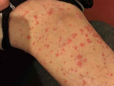 2025年12月10日 第14页