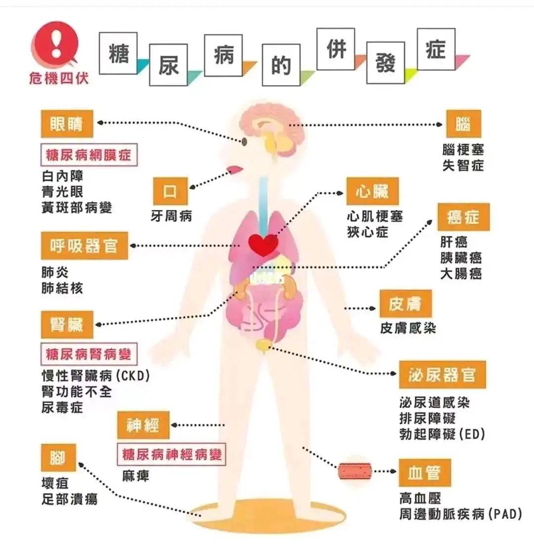糖尿病有何症状