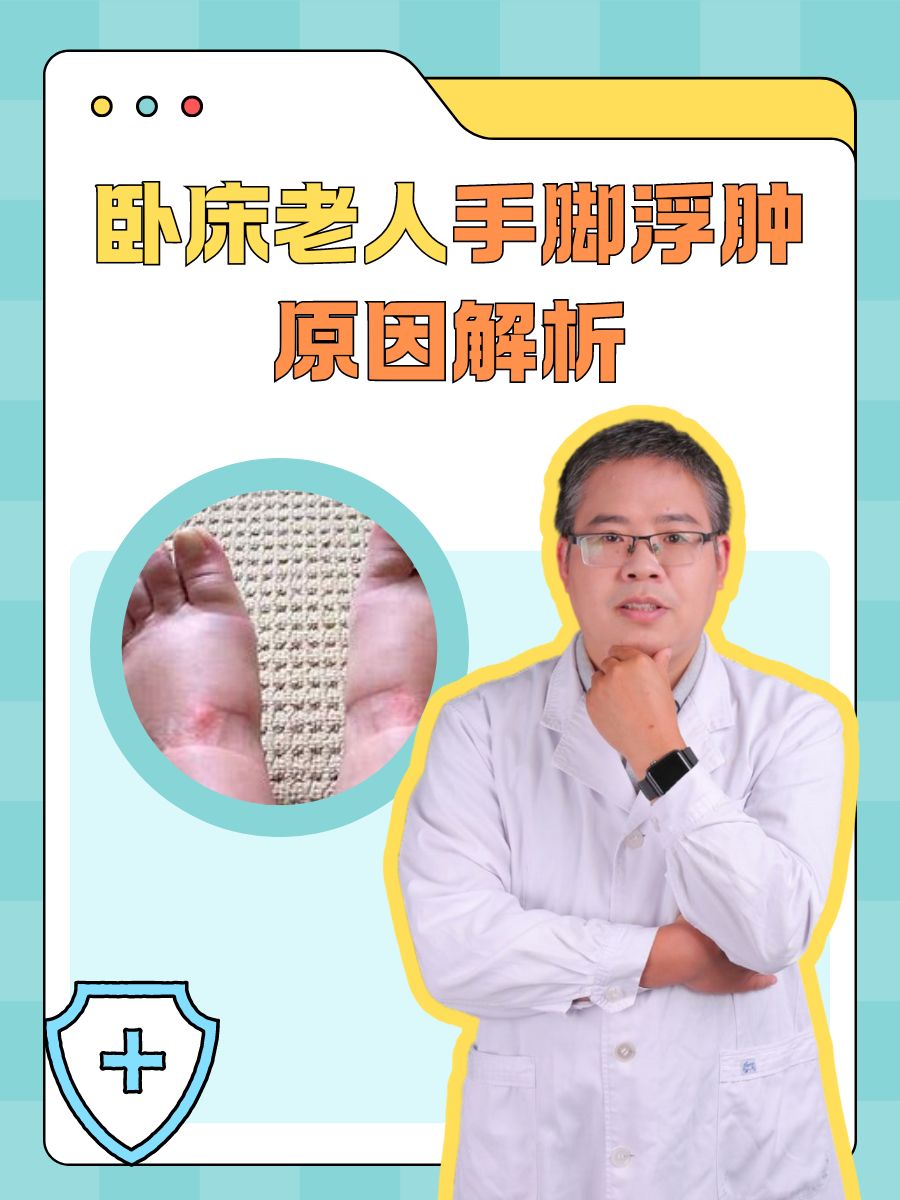 80岁老人脚肿什么原因