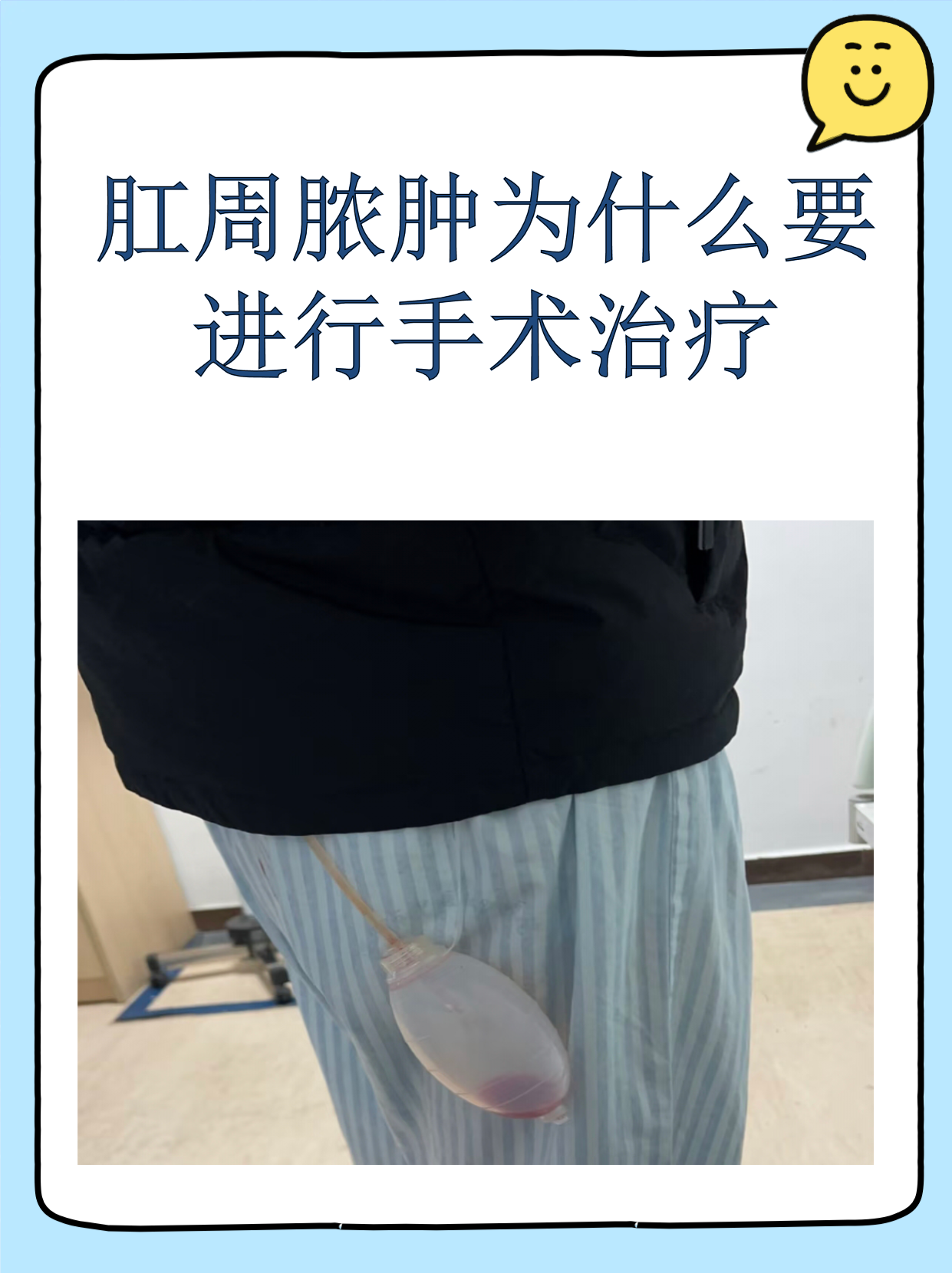 肛周囊肿一定要开刀吗?怎么治?