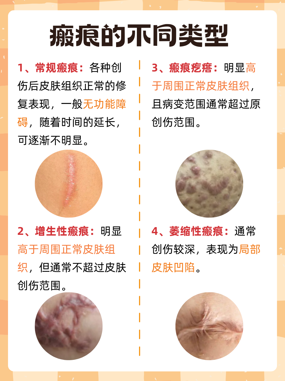 伤口结疤里边化脓应该怎么处理