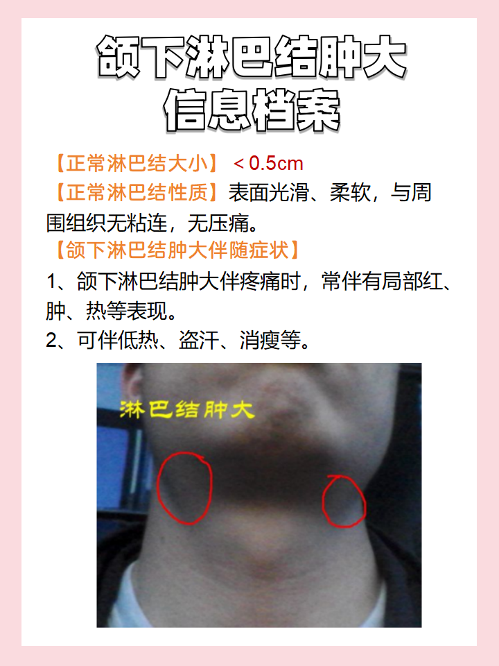 淋巴结肿大是怎么回事