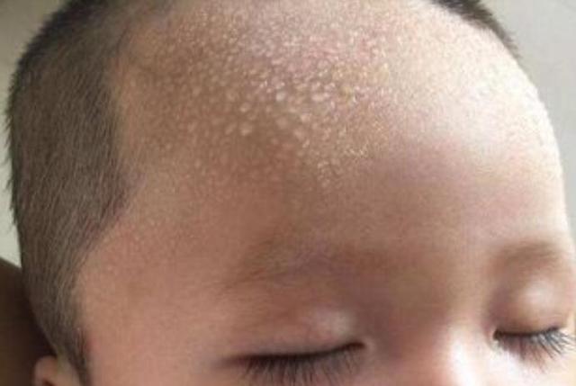 宝宝头上出汗多怎么回事